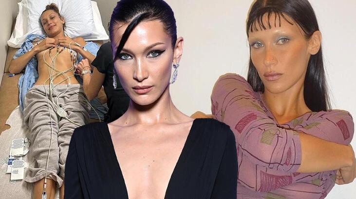 Tedavi sürecini paylaşan Bella Hadid’den ‘uyuşturucu’ açıklaması